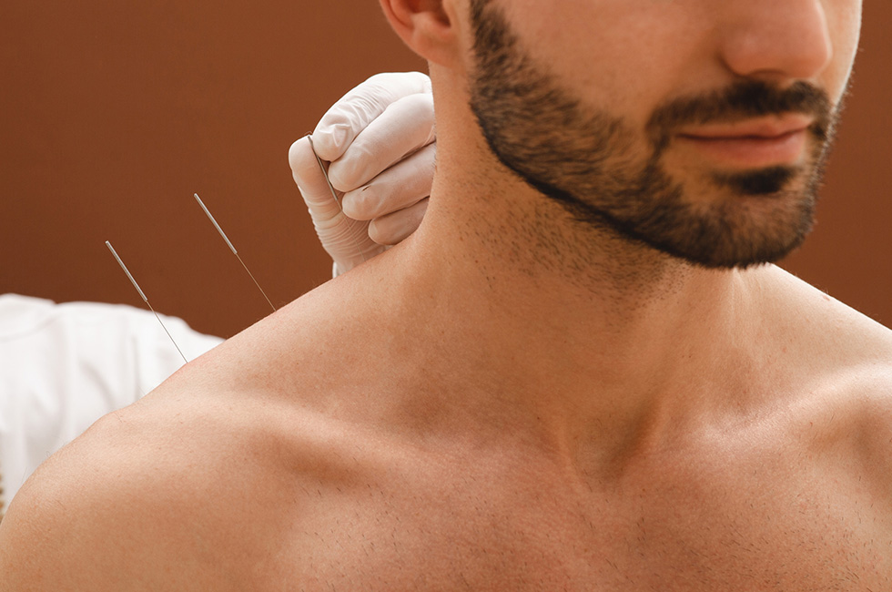 Mann bekommt Akupunktur
